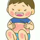 アトピー性皮膚炎の特徴と対処
